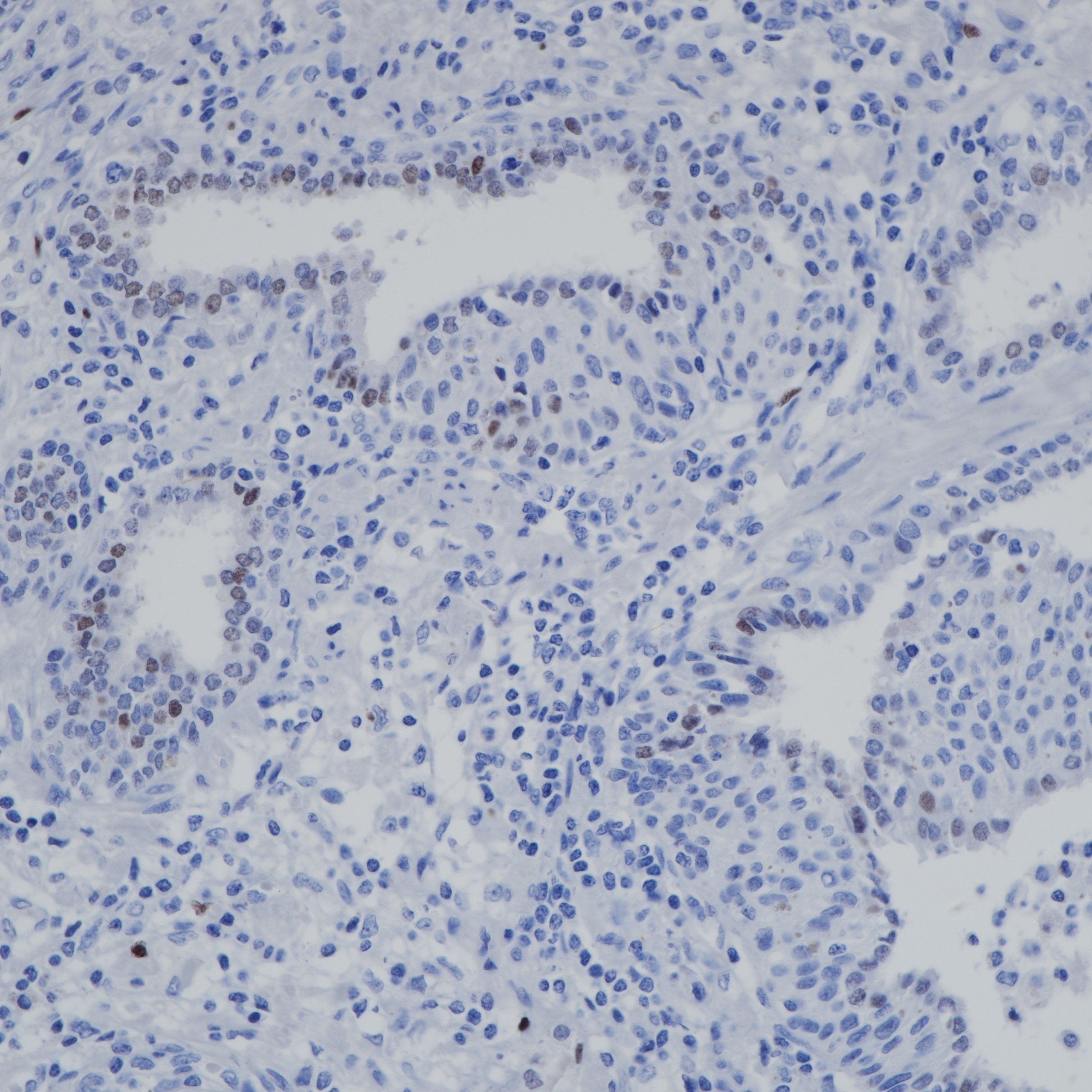Anti-AR-V7 Rabbit Monoclonal Antibody