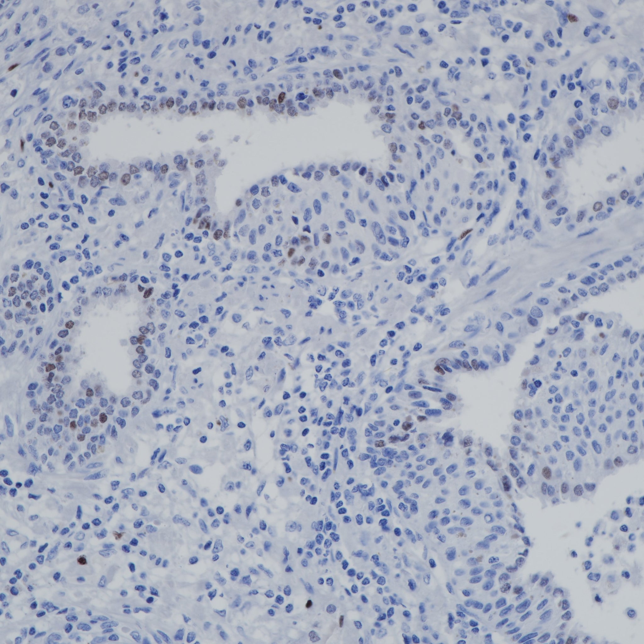 Anti-AR-V7 Rabbit Monoclonal Antibody