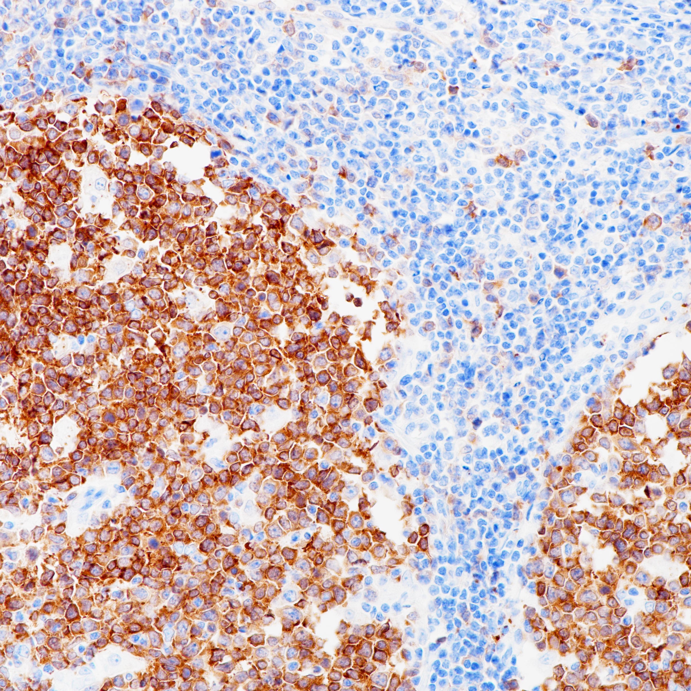 Anti-Stathmin Rabbit Monoclonal Antibody