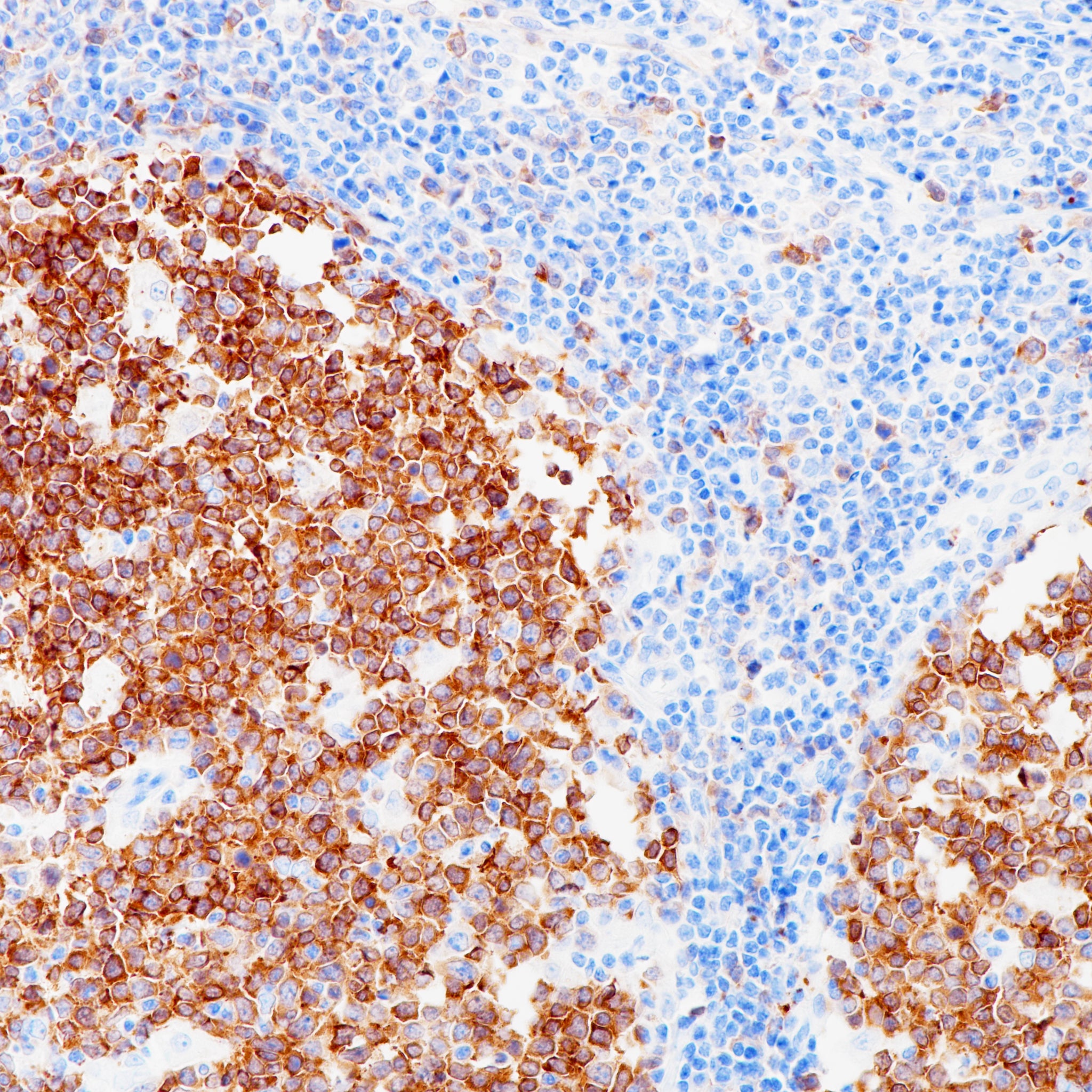 Anti-Stathmin Rabbit Monoclonal Antibody