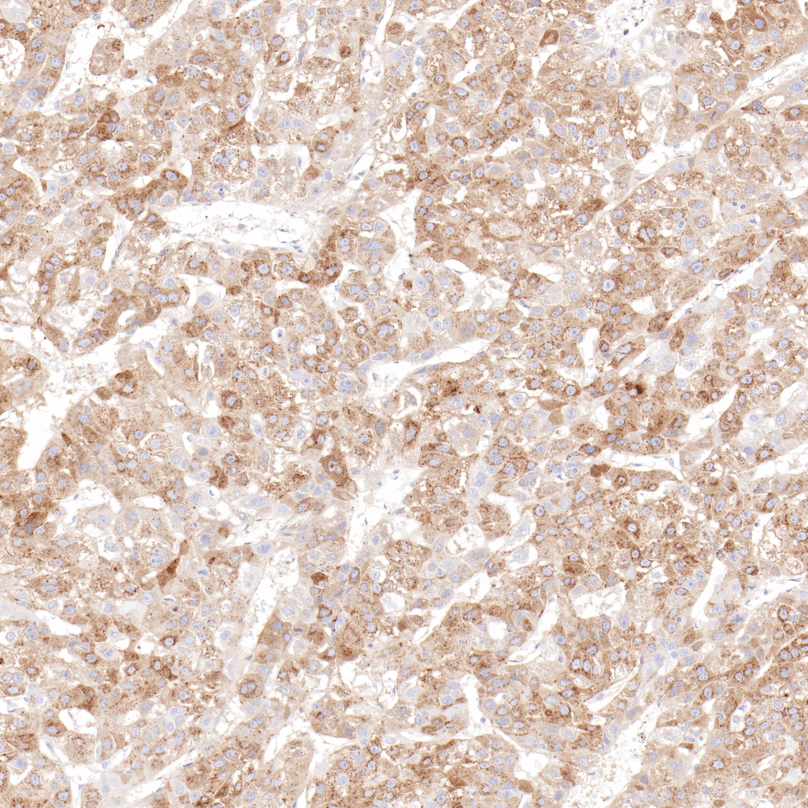 Anti-alpha 1 Fetoprotein Rabbit Monoclonal Antibody
