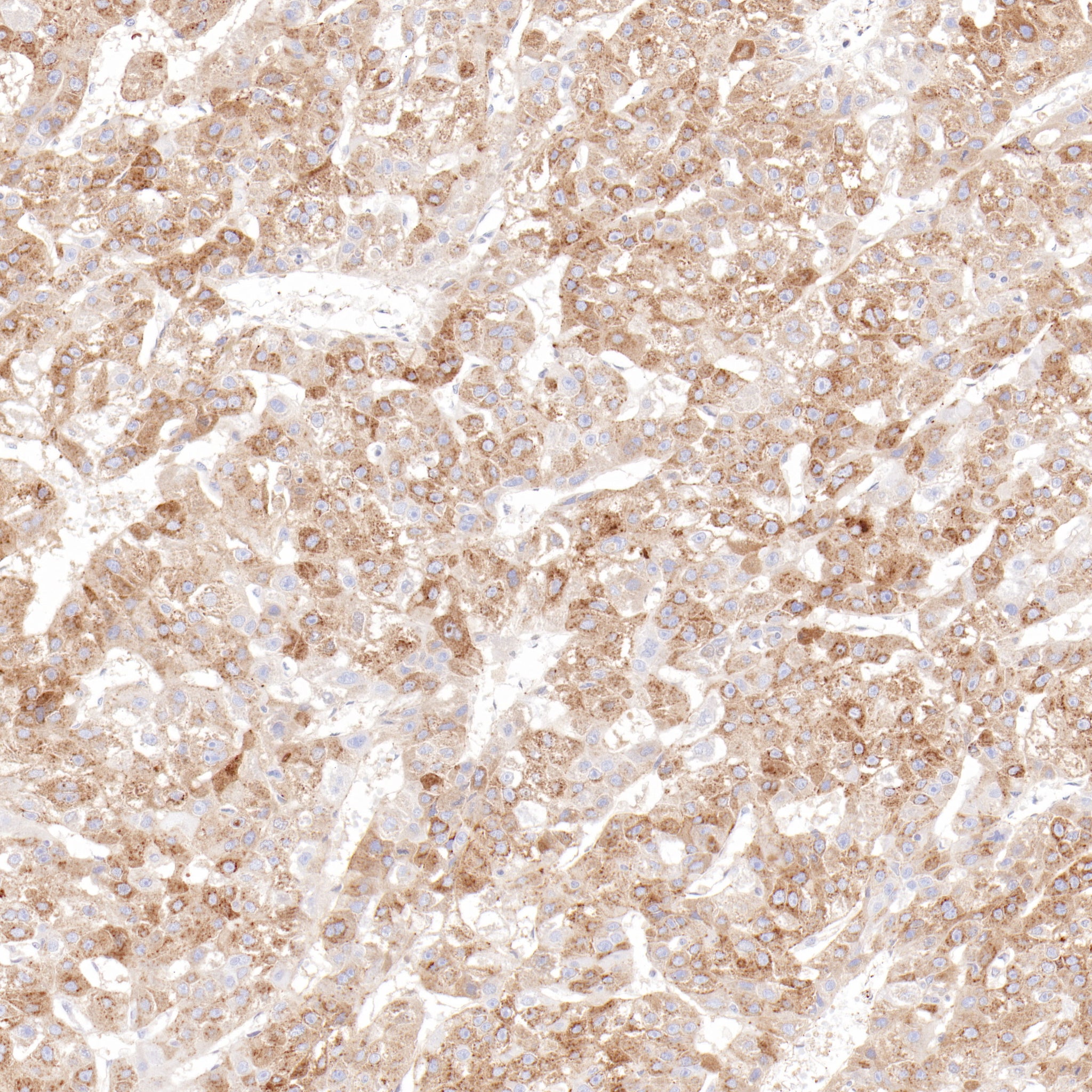 Anti-alpha 1 Fetoprotein Rabbit Monoclonal Antibody