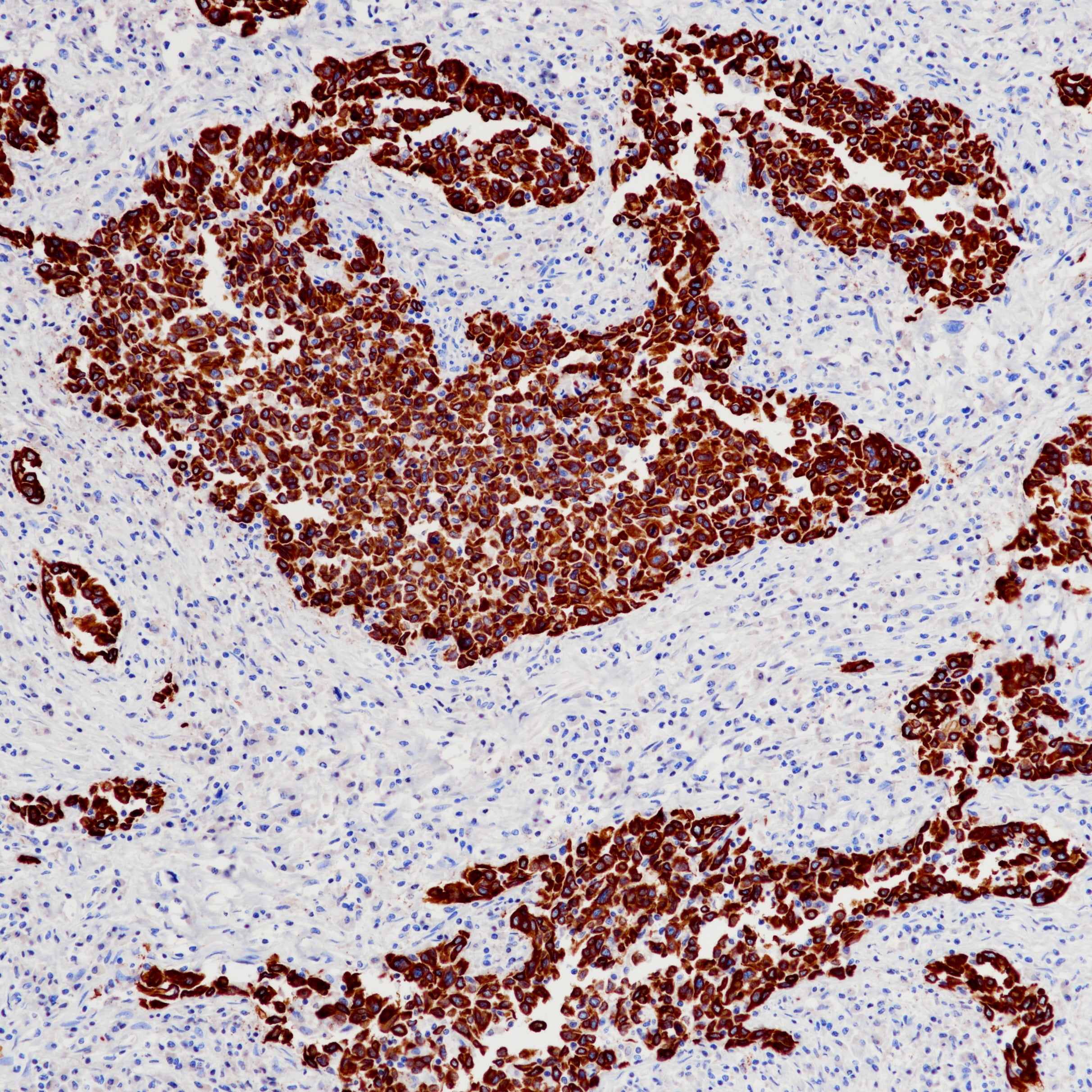 Anti-Cytokeratin 5 + 6 Rabbit Monoclonal Antibody