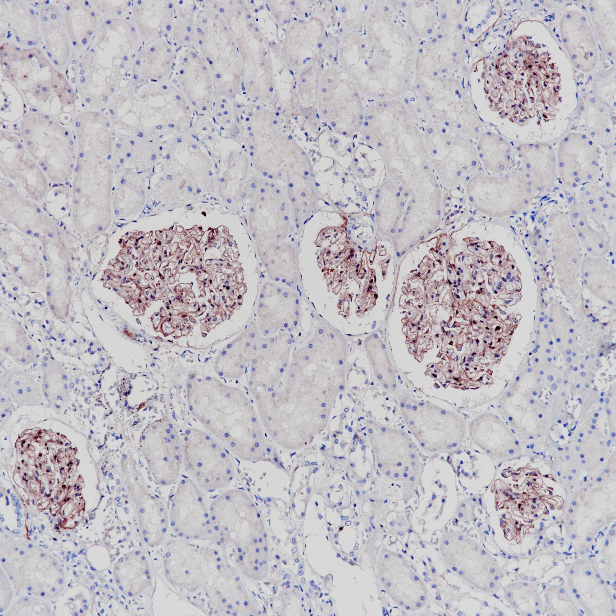 Anti-COL4A3 Rabbit Monoclonal Antibody