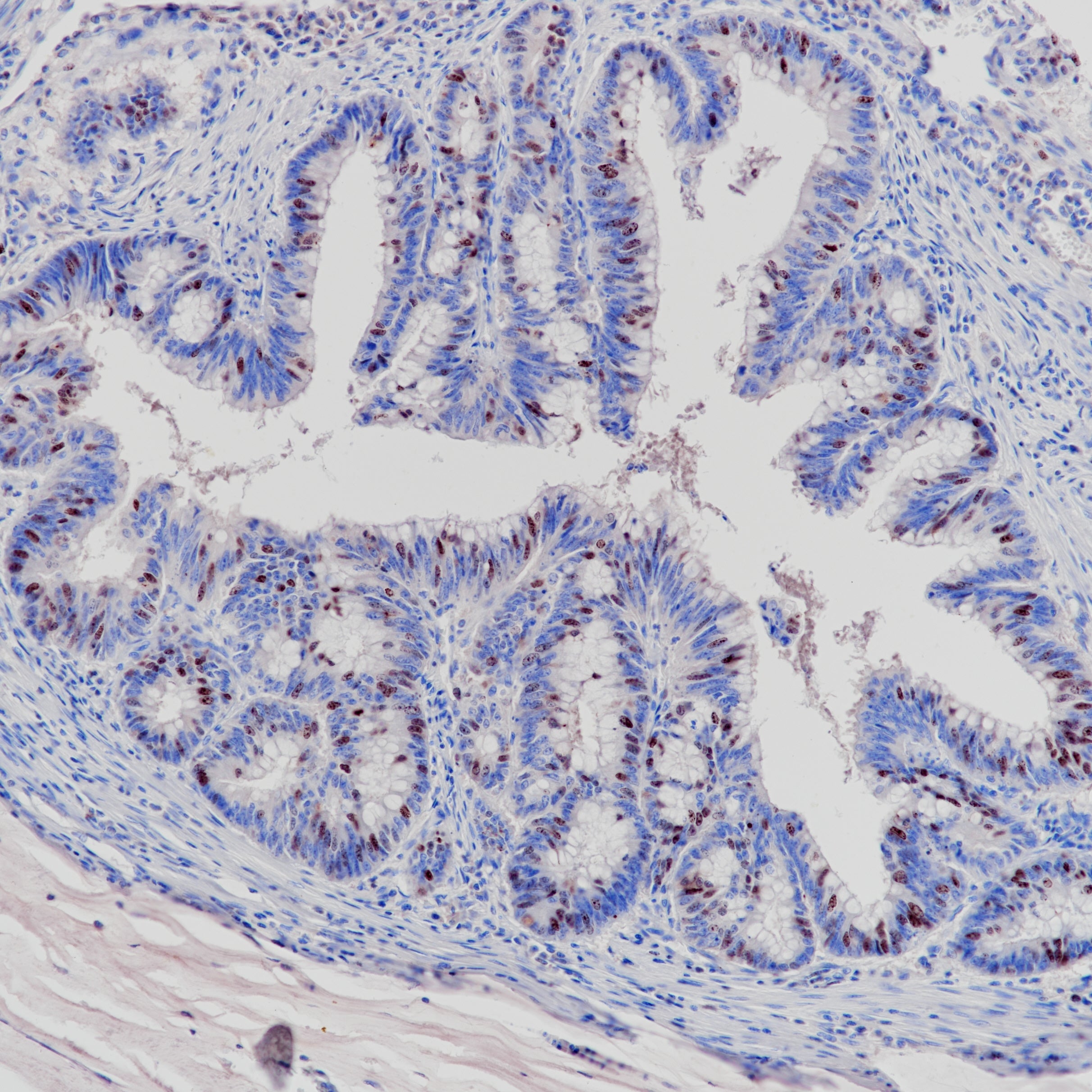 Anti-Survivin Rabbit Monoclonal Antibody