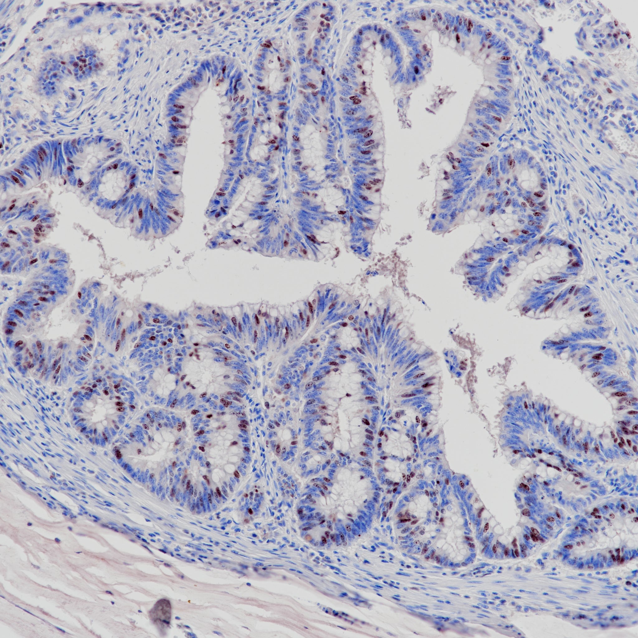 Anti-Survivin Rabbit Monoclonal Antibody