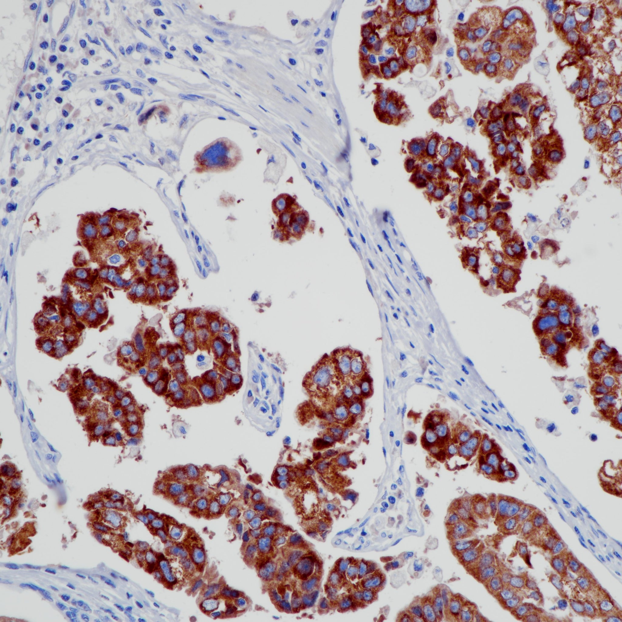 Anti-IMP3 Rabbit Monoclonal Antibody