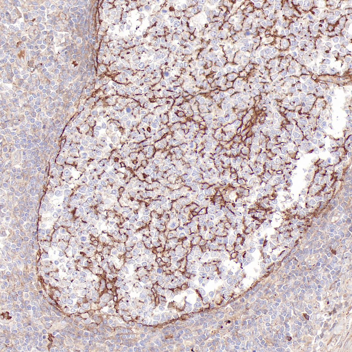 Anti-Clusterin Rabbit Monoclonal Antibody