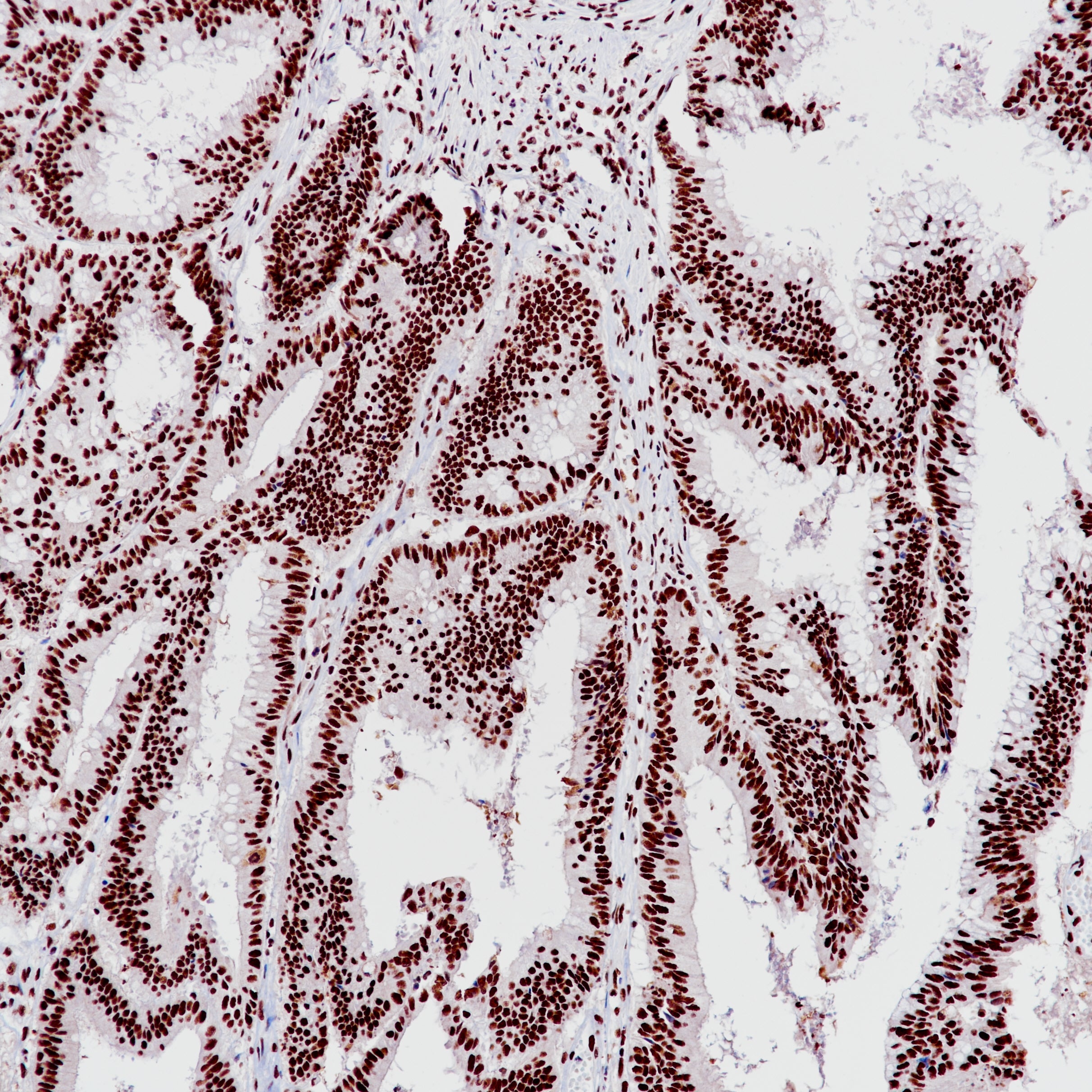 Anti-SMARCB1 Rabbit Monoclonal Antibody