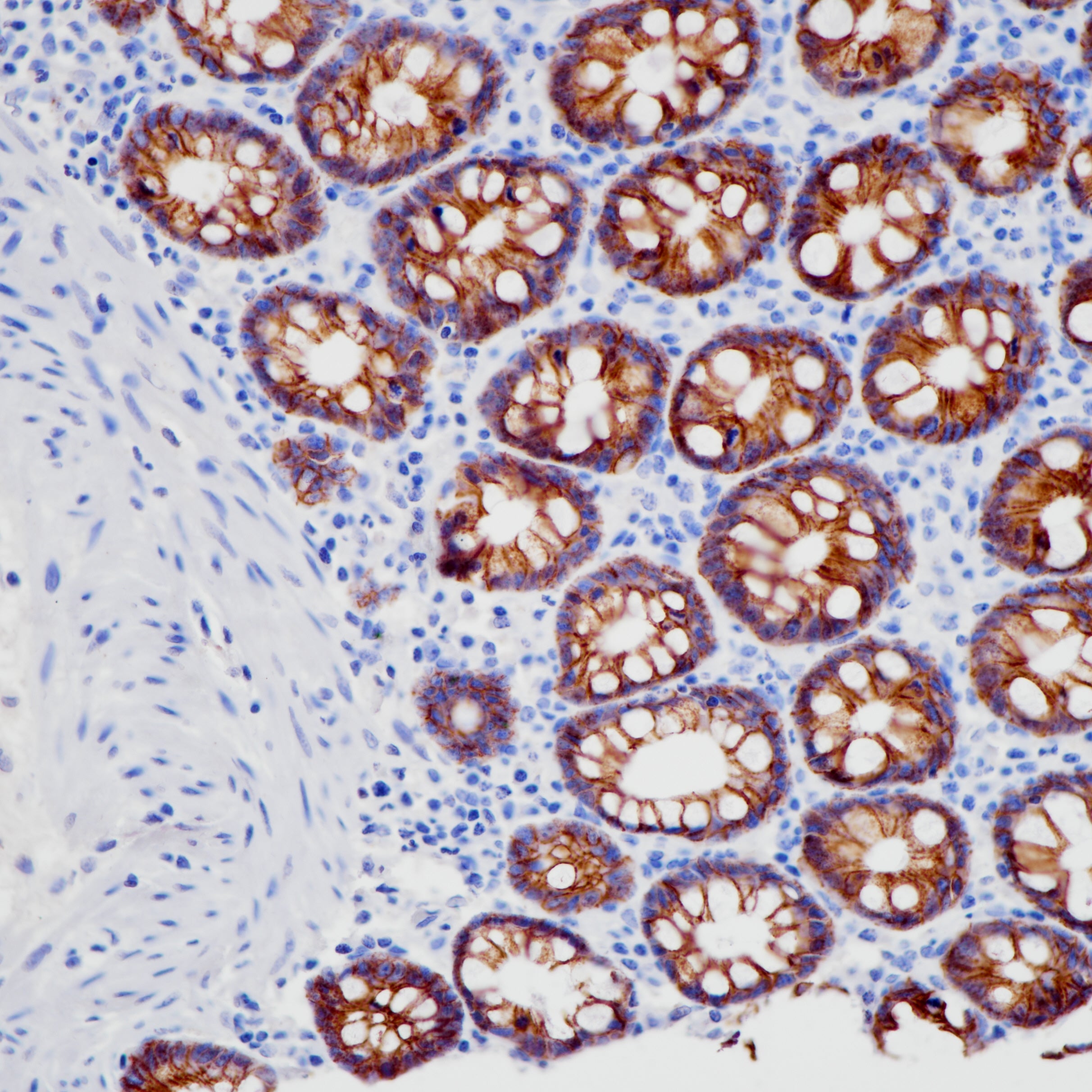 Anti-LI Cadherin Rabbit Monoclonal Antibody