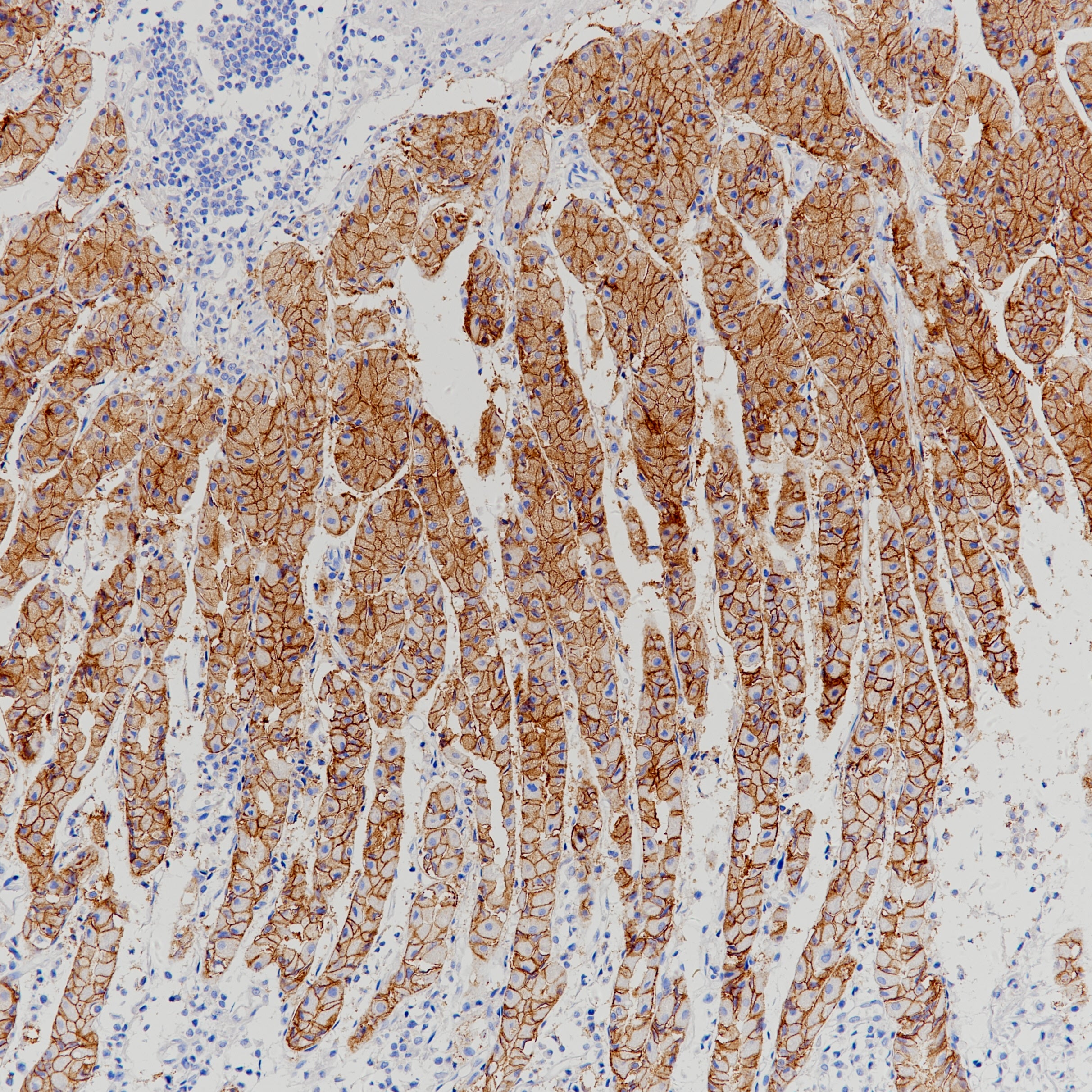 Anti-Claudin 18.2 Rabbit Monoclonal Antibody
