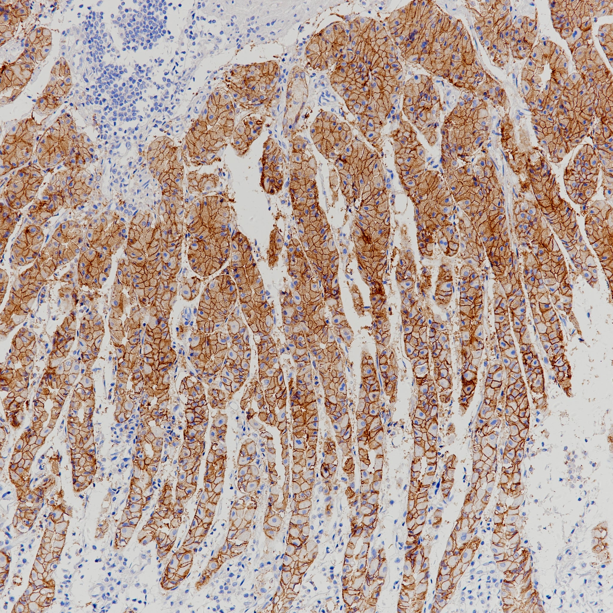 Anti-Claudin 18.2 Rabbit Monoclonal Antibody