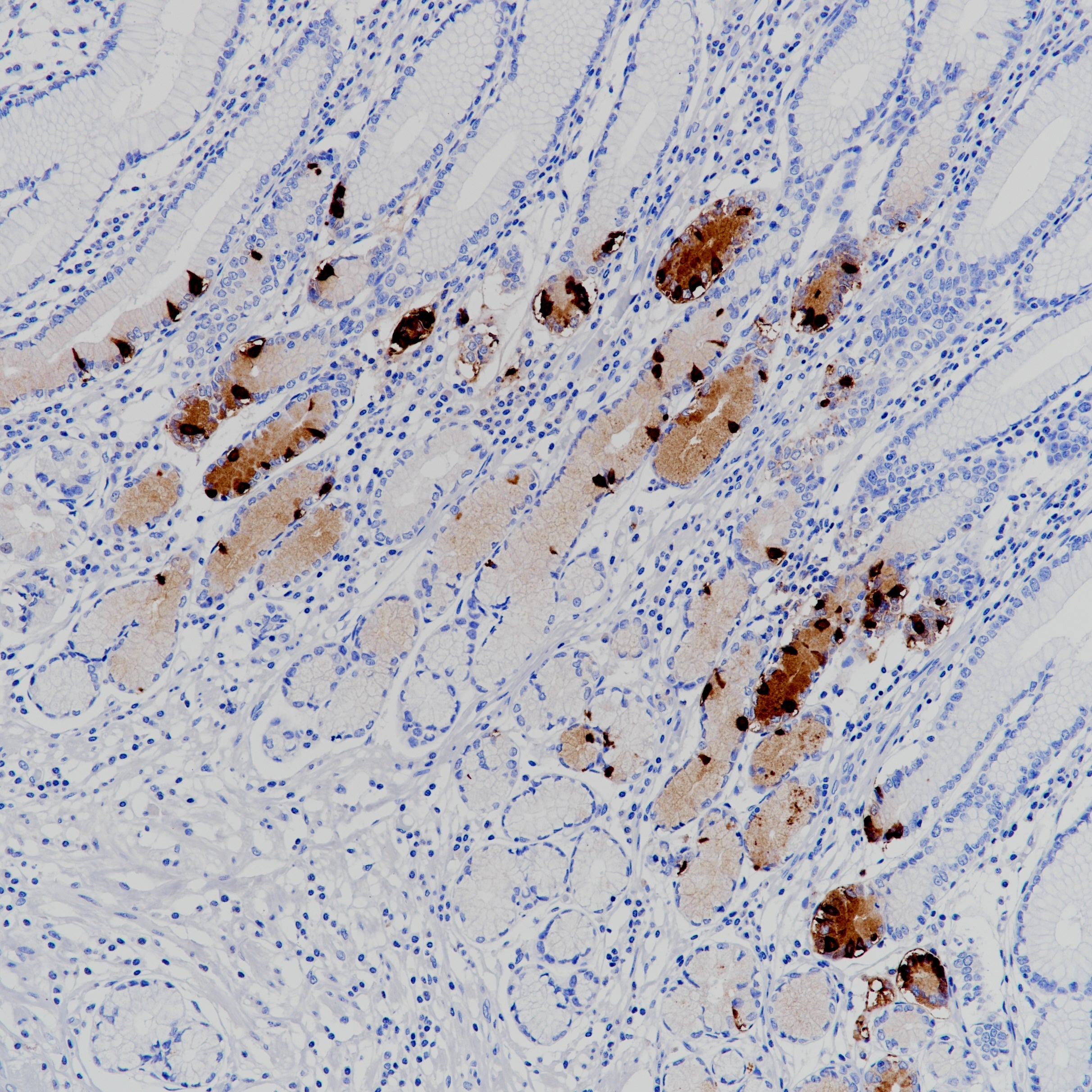 Anti-Gastrin Rabbit Monoclonal Antibody