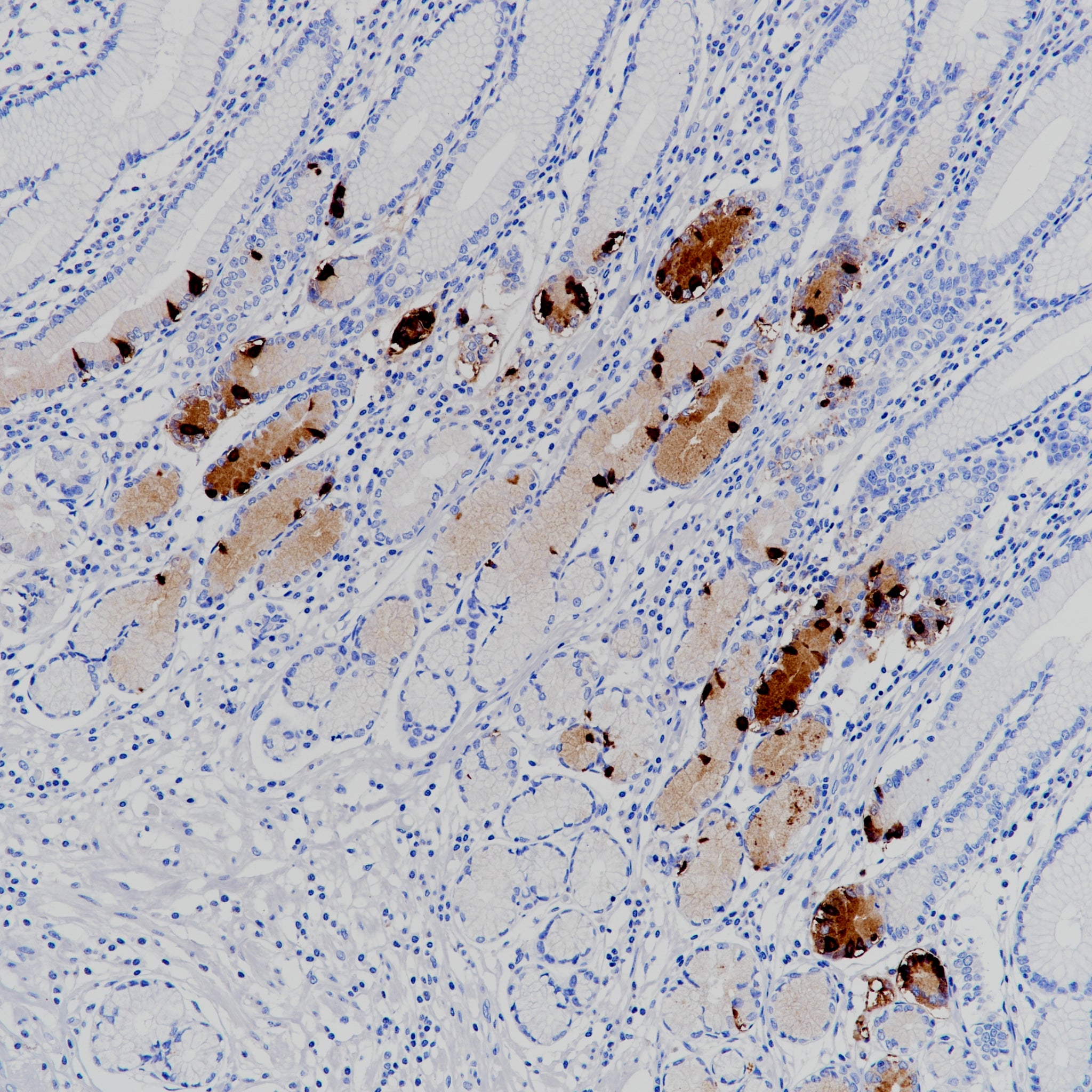 Anti-Gastrin Rabbit Monoclonal Antibody