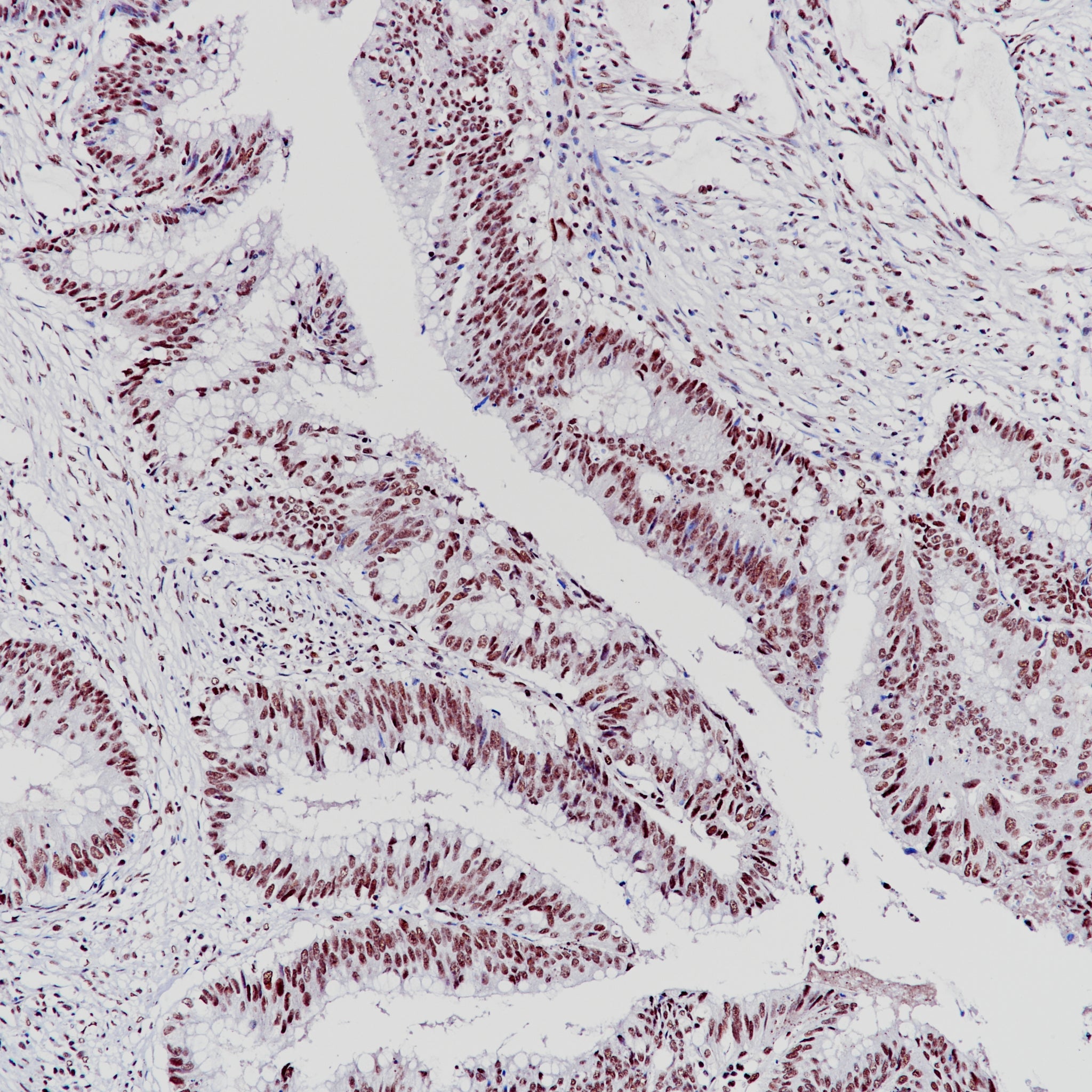 Anti-BAP1 Rabbit Monoclonal Antibody