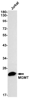 Anti-MGMT Rabbit Monoclonal Antibody