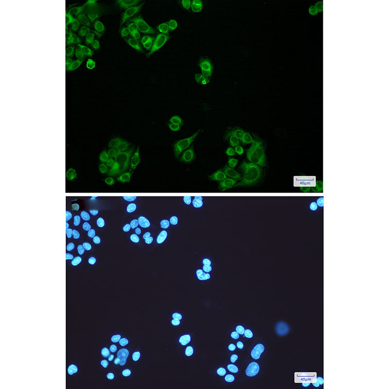 Anti-ELOVL5 Rabbit Monoclonal Antibody