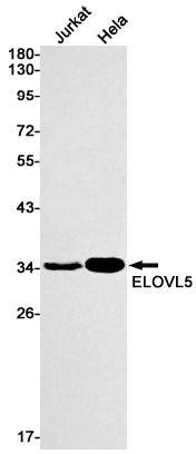 Anti-ELOVL5 Rabbit Monoclonal Antibody