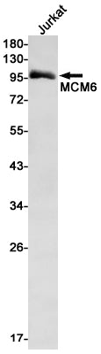 Anti-MCM6 Rabbit Monoclonal Antibody