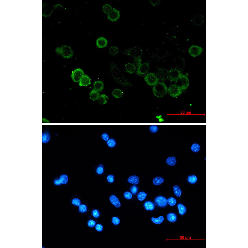 Anti-E Cadherin Rabbit Monoclonal Antibody