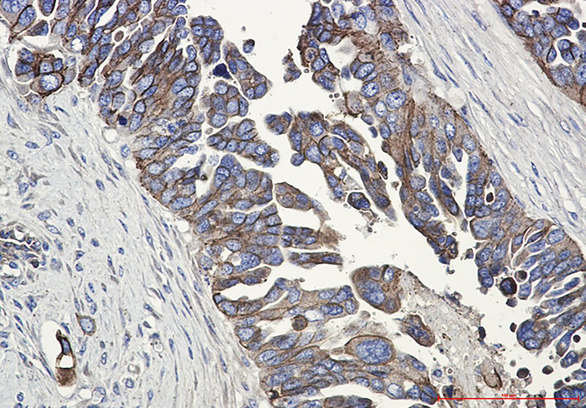 Anti-E Cadherin Rabbit Monoclonal Antibody