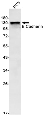 Anti-E Cadherin Rabbit Monoclonal Antibody