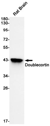 Anti-Doublecortin Rabbit Monoclonal Antibody