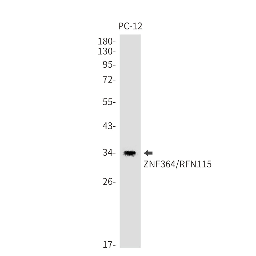 Anti-ZNF364 Rabbit Monoclonal Antibody