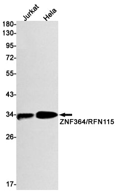 Anti-ZNF364 Rabbit Monoclonal Antibody