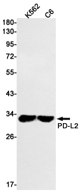 Anti-PD L2 Rabbit Monoclonal Antibody