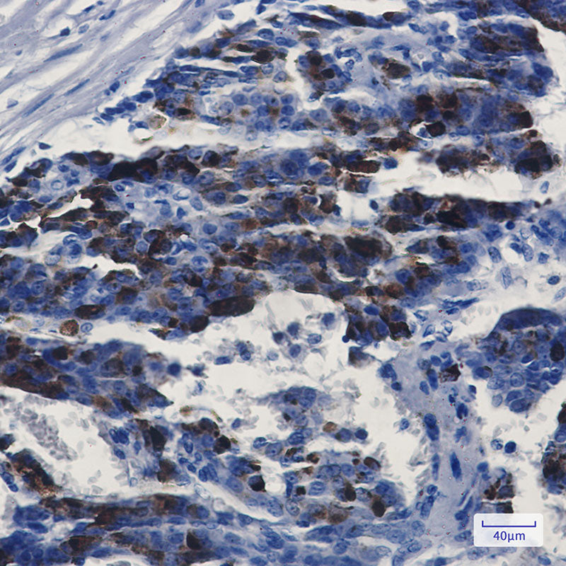Anti-MMP14 Rabbit Monoclonal Antibody