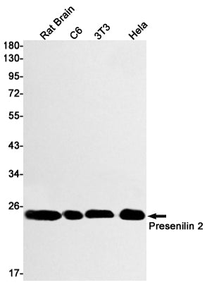 Anti-Presenilin 2 Rabbit Monoclonal Antibody