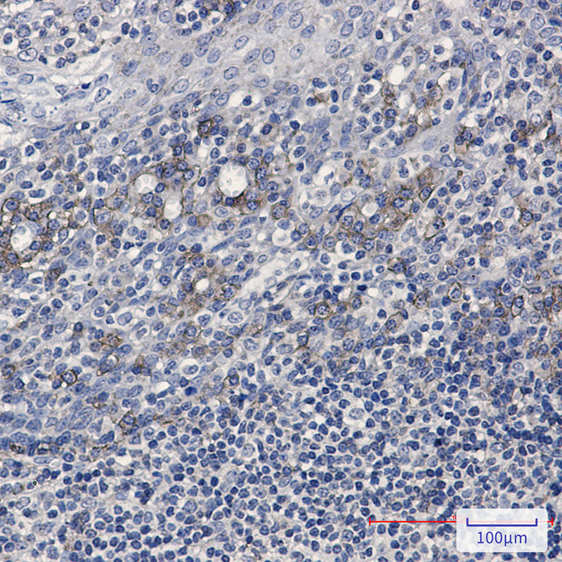 Anti-CD32B Rabbit Monoclonal Antibody