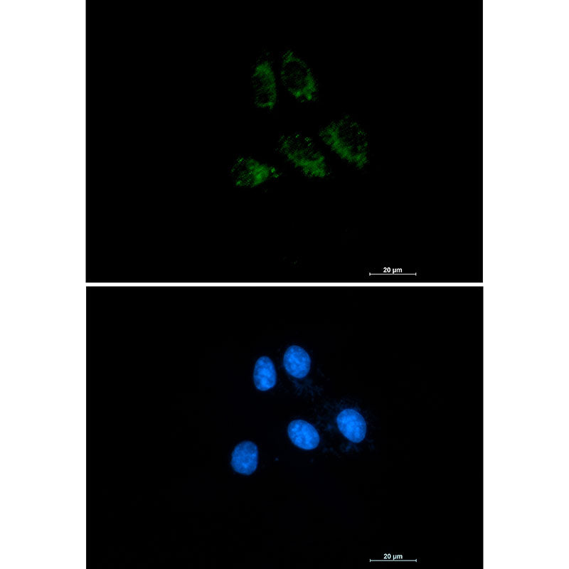 Anti-Thrombomodulin Rabbit Monoclonal Antibody