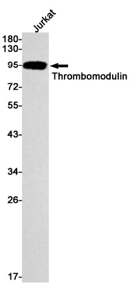 Anti-Thrombomodulin Rabbit Monoclonal Antibody