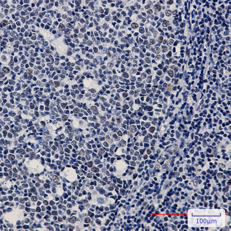 Anti-WTAP Rabbit Monoclonal Antibody
