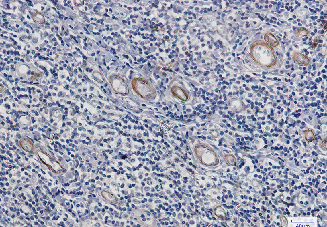 Anti-Asparagine Synthetase Rabbit Monoclonal Antibody