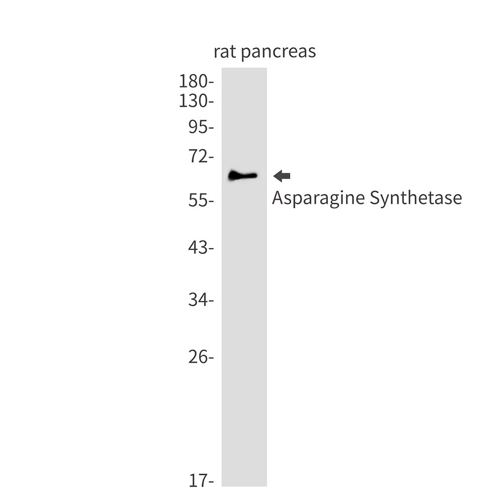 Anti-Asparagine Synthetase Rabbit Monoclonal Antibody