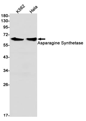 Anti-Asparagine Synthetase Rabbit Monoclonal Antibody