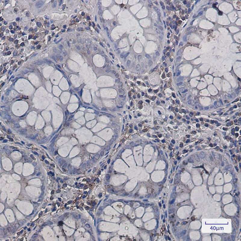 Anti-Annexin VI Rabbit Monoclonal Antibody