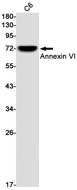 Anti-Annexin VI Rabbit Monoclonal Antibody