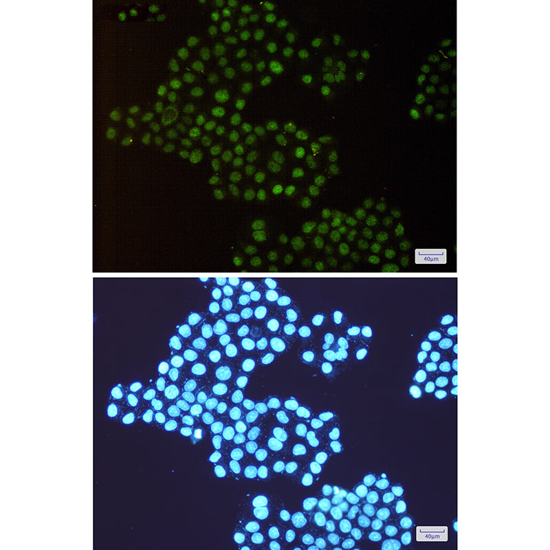 Anti-TRMT2A Rabbit Monoclonal Antibody
