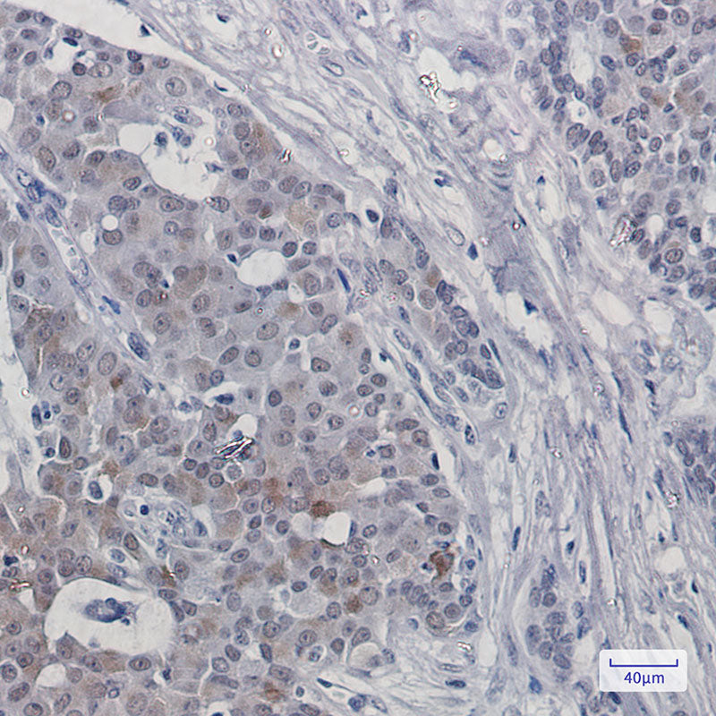 Anti-TRMT2A Rabbit Monoclonal Antibody