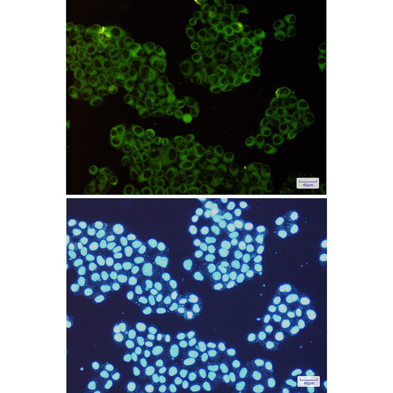 Anti-ROCK2 Rabbit Monoclonal Antibody
