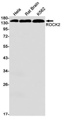 Anti-ROCK2 Rabbit Monoclonal Antibody