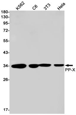 Anti-PPP4C Rabbit Monoclonal Antibody
