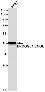 Anti-ENDOGL1 Rabbit Monoclonal Antibody