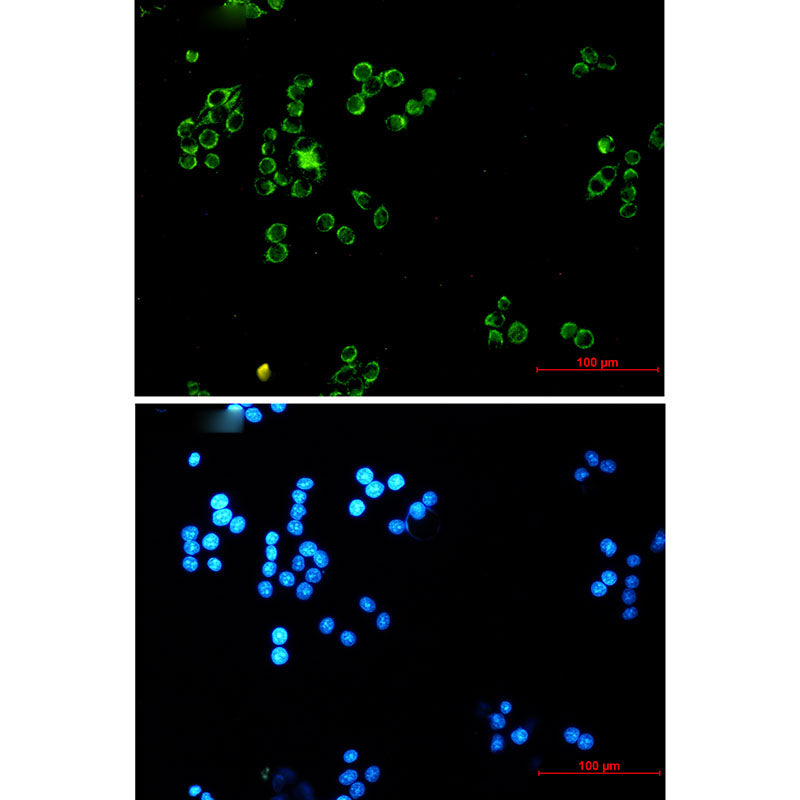 Anti-Lipoamide Dehydrogenase Rabbit Monoclonal Antibody