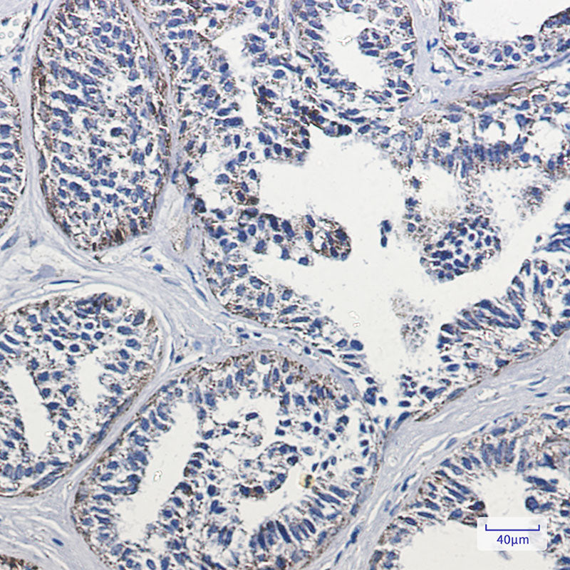 Anti-Lipoamide Dehydrogenase Rabbit Monoclonal Antibody