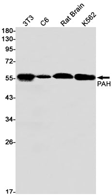 Anti-PAH Rabbit Monoclonal Antibody